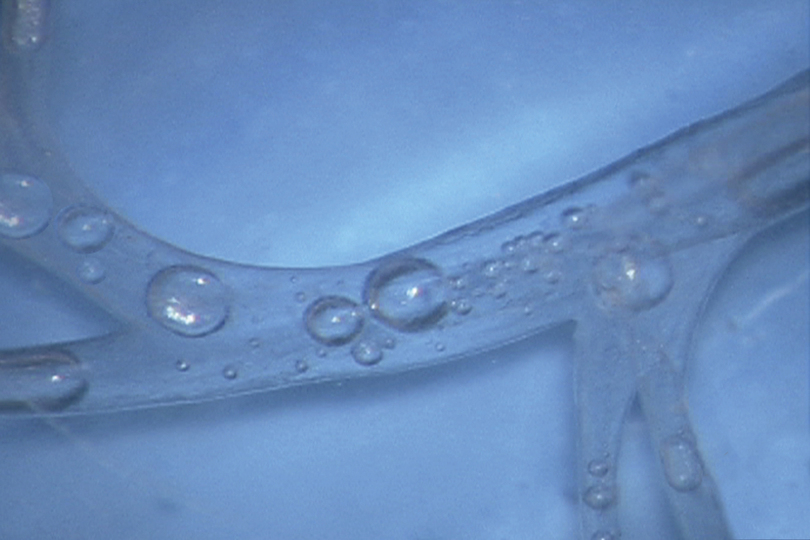 EndoActivator System Advanced Endodontics