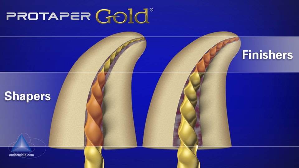 Protaper Sequence Chart